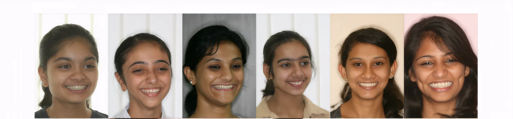Patient with a bright, balanced smile after care