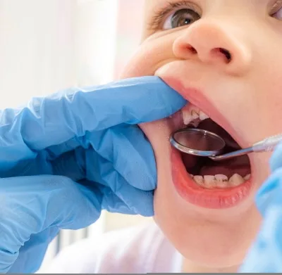 Pediatric dentistry consultation placeholder image